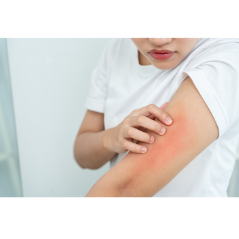 Stop the Itch at the Source: A Chemical Engineer's Guide to Biofilm, Anti-Virulence, and the No-No Itchy Gel - Ms. Chu Soap & Beaut