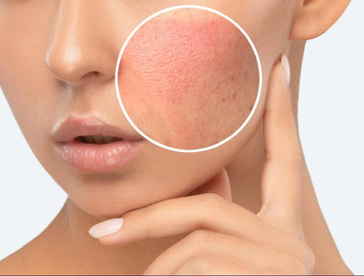 10大香港天然護膚品推薦 2025