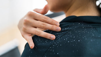 White flakes on the shoulder of a dark top being brushed away by hand — dandruff falling from the scalp
