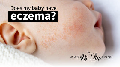 Does my baby have eczema?