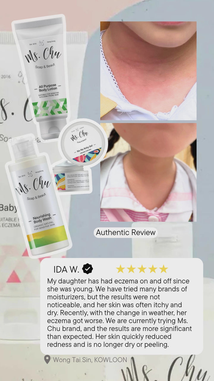 Eczema Skincare All Purpose Body Lotion | Soothing Relief – Ms. Chu